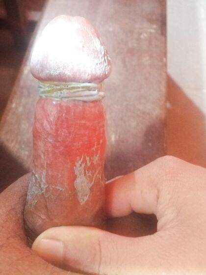 MyDick