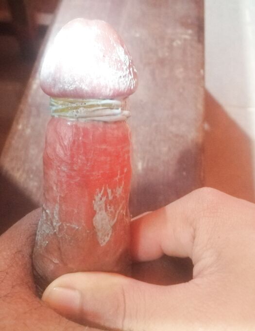MyDick